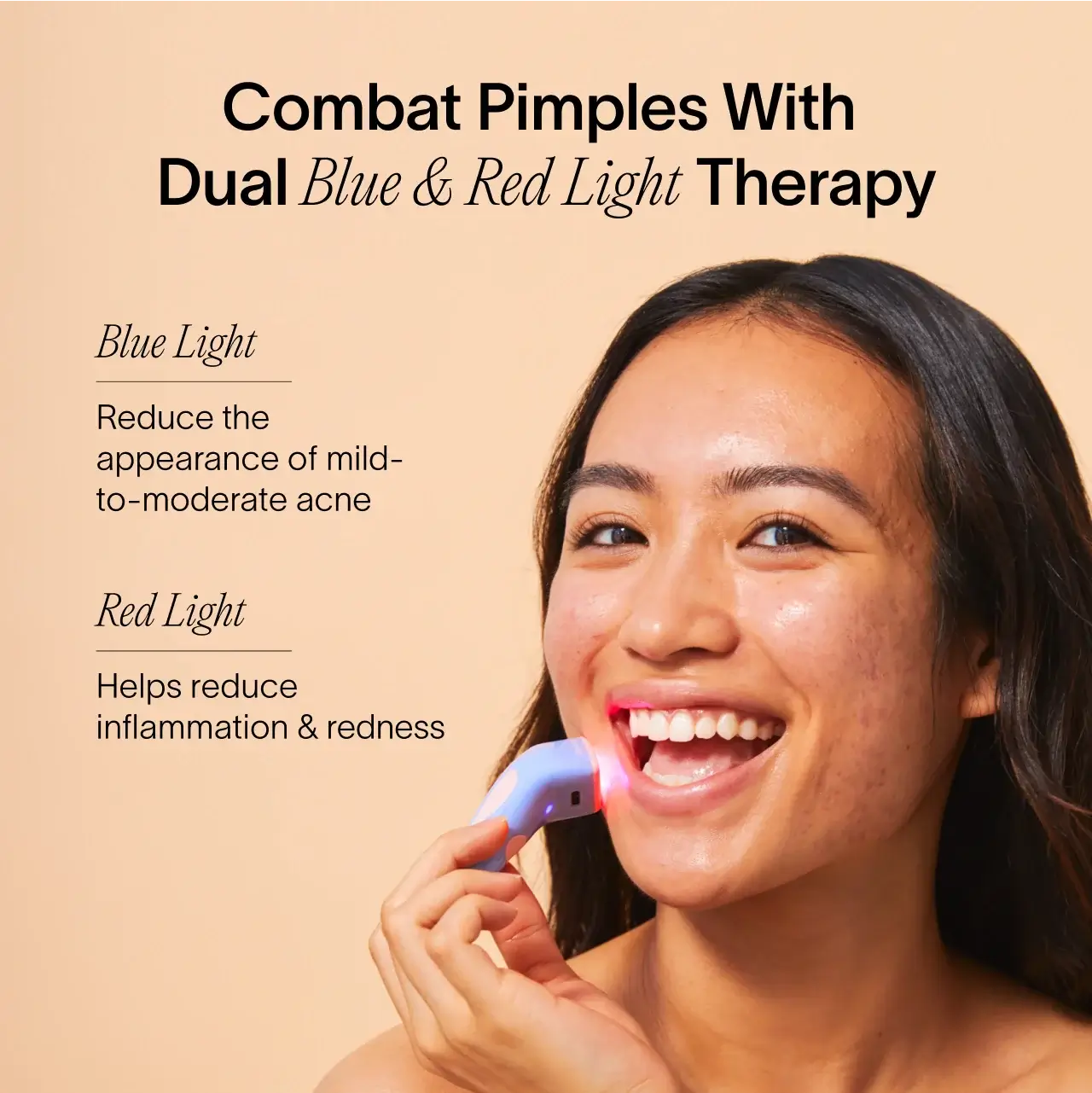 Bye Acne: 3-Minute Pimple Spot Treatment - Image 10