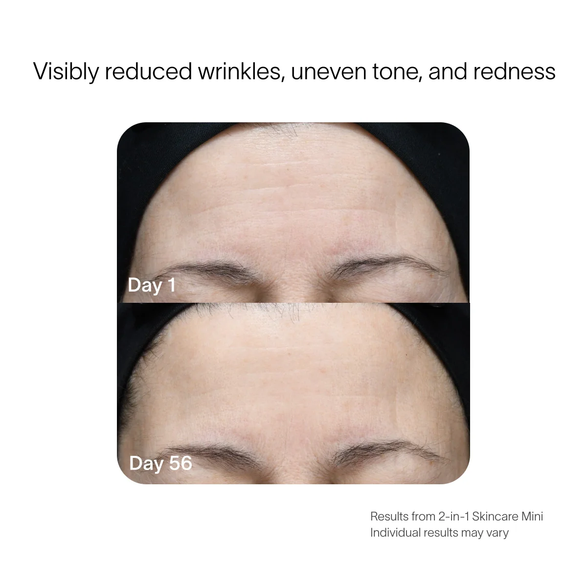 Radiant Renewal 2-in-1 Skincare Mini - Image 7