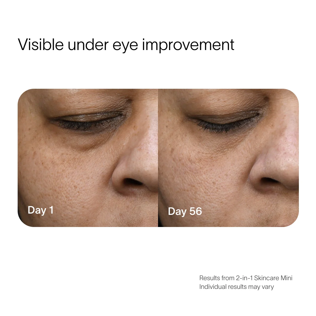 Radiant Renewal 2-in-1 Skincare Mini - Image 8